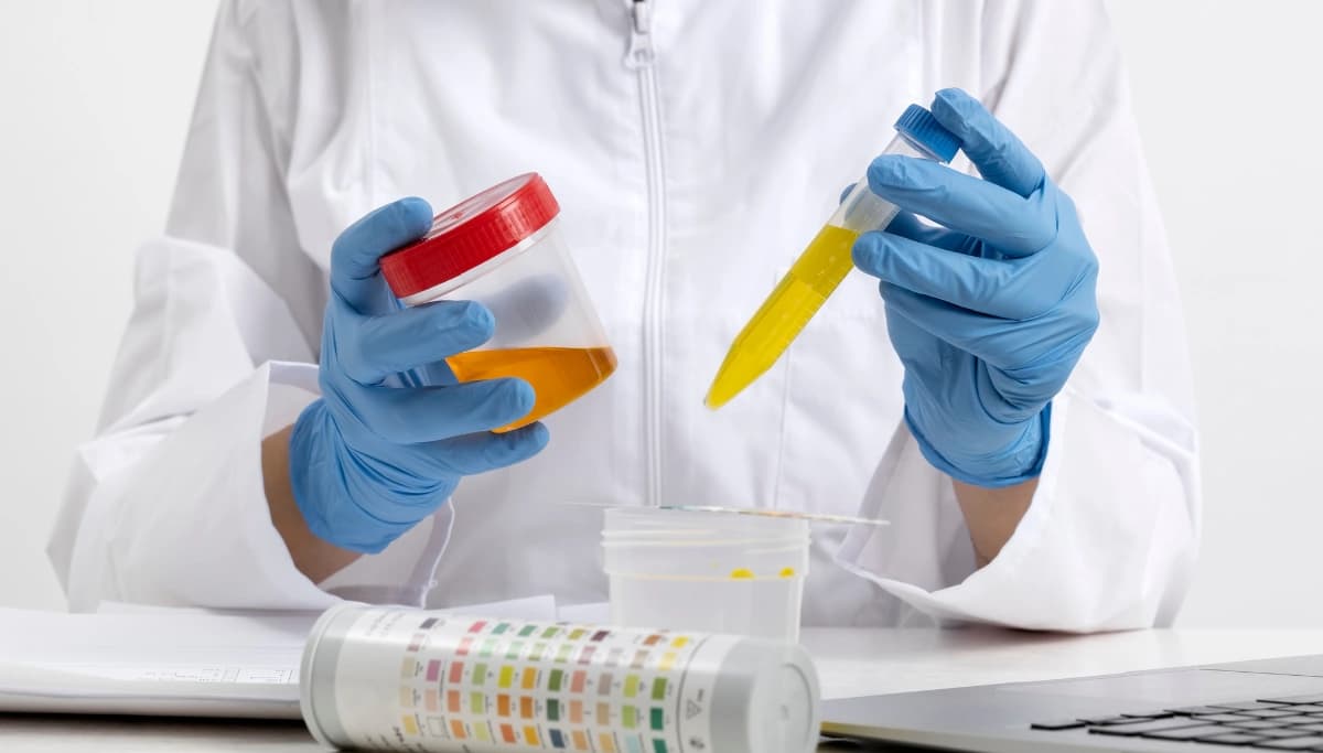 Prueba antidoping para detectar sustancias en una muestra