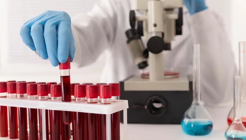 Profesional de la salud realizando un estudio de quimica sanguínea